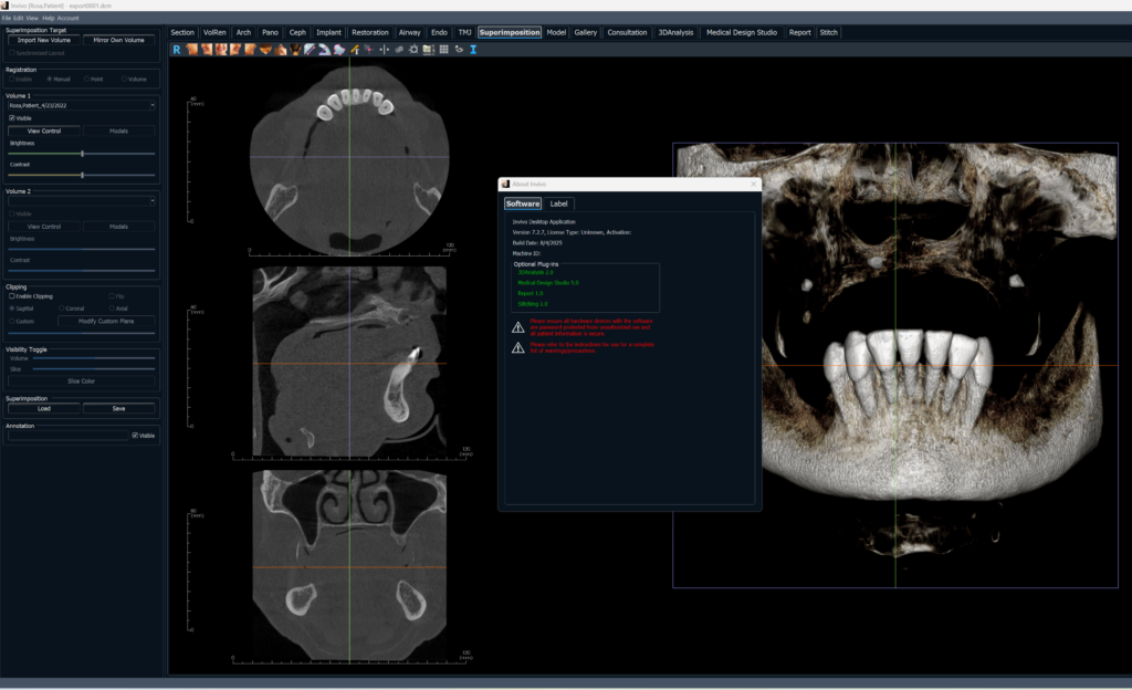invivodental 7.2.7 unlimited invivodental 7.2.7 unlimited